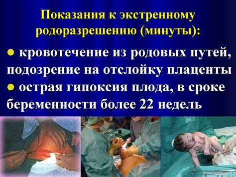 Преэклампсия. Эклампсия. Лечение. Профилактика - презентация онлайн