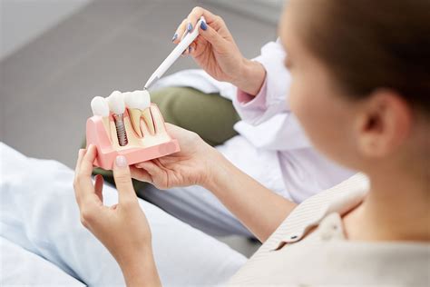Affordable Dental Implants near me | Implants in California