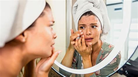Pallor: 11 causes of pale skin | HealthShots