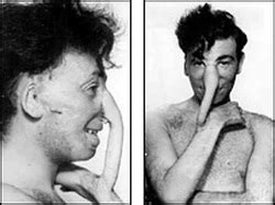 Reconstructive Surgery - The History and Evolution of Wartime Medical ...