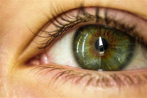 bilateral isohypochromia - Google Search | Green eyes, Green aesthetic ...
