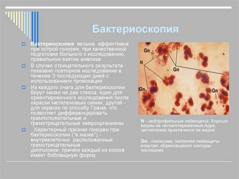 Гонорея. Особенности гонореи у женщин - презентация онлайн