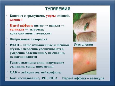 Дифференциальная диагностика заболеваний, сопровождающихся развитием ...