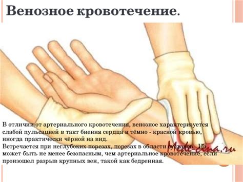 Первая помощь при кровотечениях