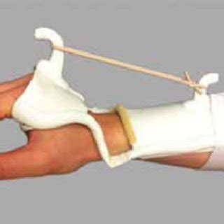 Dynamic wrist extension splint. | Download Scientific Diagram