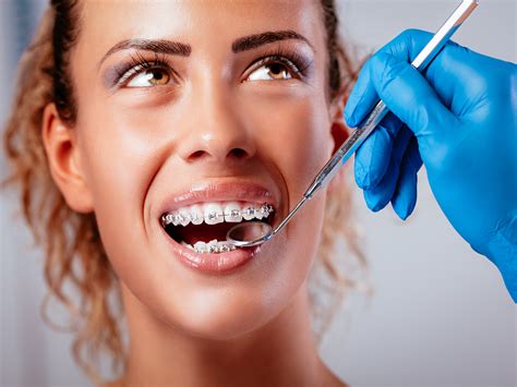 How can I close my braces gap faster?
