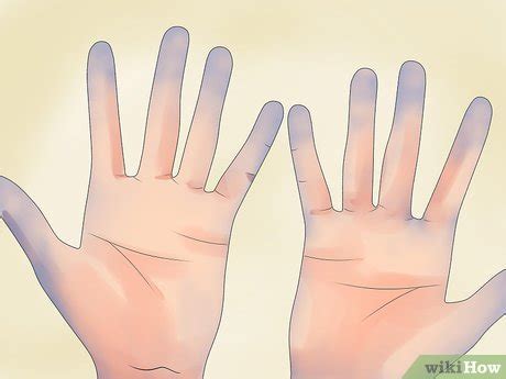 How to Prepare for Surgery when You Have Lupus: 15 Steps