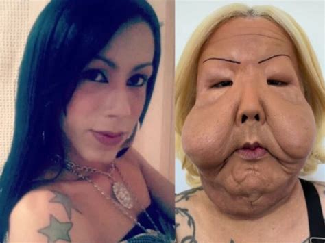 Como Era A Juju Do Pix Antes - FOTOS: Confira antes e depois de Juju do Pix após primeira cirurgia no ...