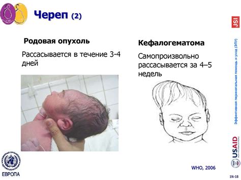 Полный осмотр новорожденного ребенка - презентация онлайн