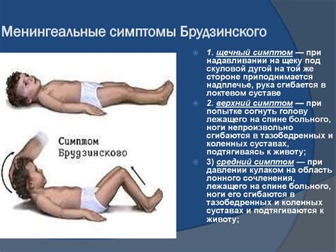 Лечение воспалительных заболеваний ЦНС - презентация онлайн