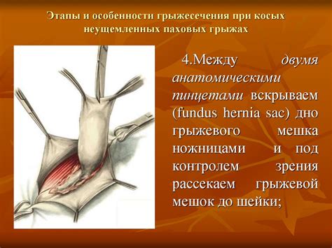 Топографо-анатомические предпосылки возникновения грыж различной ...