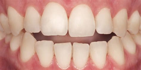 Ormco - 60 Years of Only Orthodontics. Let's Empower You!