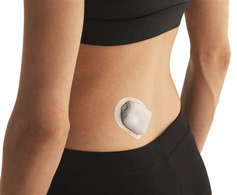insulin patch pumps market   witness substantial growth owing