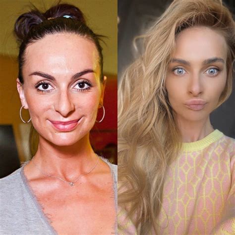 Что делала с лицом Екатерина Варнава. Как ей удалось так измениться ...