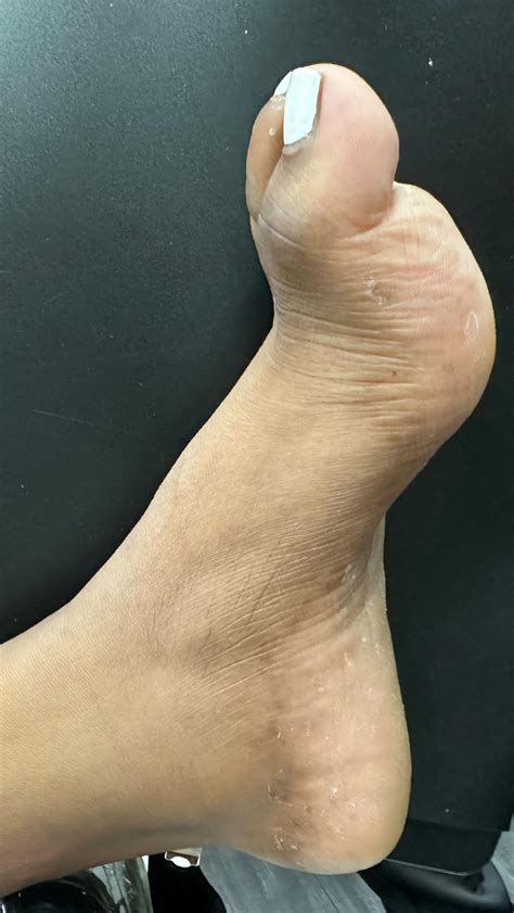 Foot First Podiatry (@footfirstpod) • Instagram photos and videos