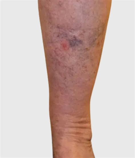 Medical Conditions We Treat | The Whiteley Clinic
