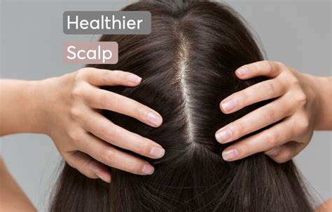 Best tips for healthier scalp - according to Dermatologists | MDhair