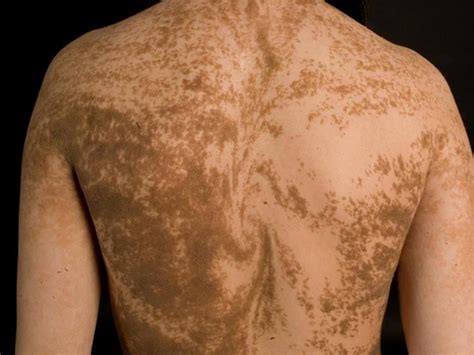 humans   secret stripes   strange markings