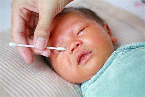 Cotonete Para Limpar Umbigo De Bebe - Cotonete De Algodão Do Uso Da Mãe Umedecido Com O álcool Para Limpar ...