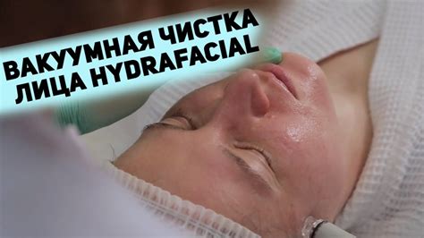 Чистое лицо за полчаса! Вакуумная чистка лица HydraFacial - YouTube