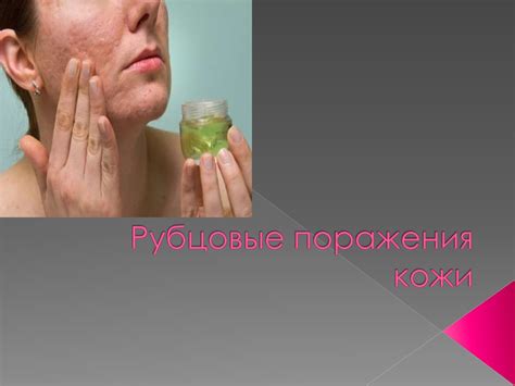 Рубцовые поражения кожи - online presentation