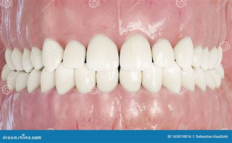 The human teeth stock illustration. Illustration of gingivitis - 165074816