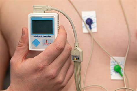 How Is AFib Diagnosed? — Dr. AFib™