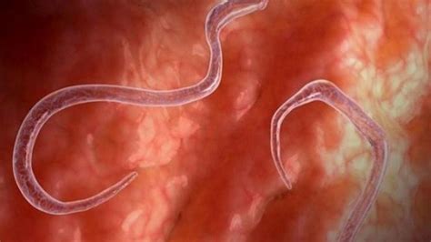 detail gambar parasit  mengerikan koleksi nomer