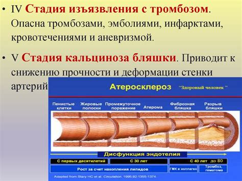 Патология сердечно-сосудистой системы - презентация онлайн