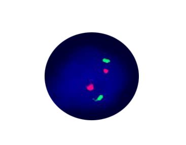 7q Deletion Detection Kit