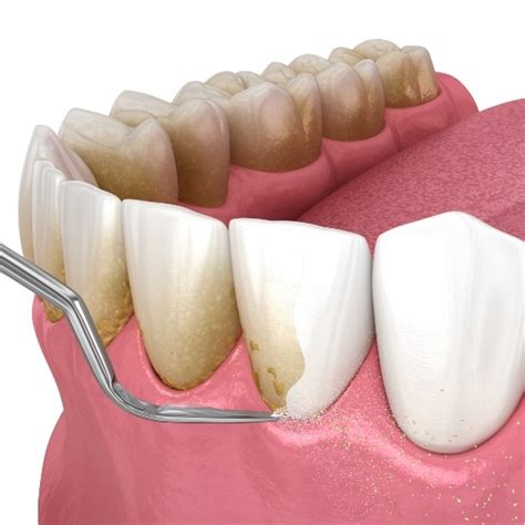 how to fix gum disease