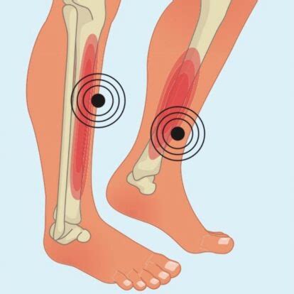 shin splints      womens running