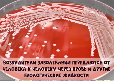 Где нельзя подцепить венерическое заболевание - Красота и здоровье ...