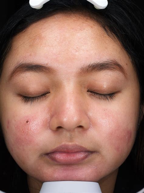 Dr Nina Wines- Medical & Laser Dermatologist