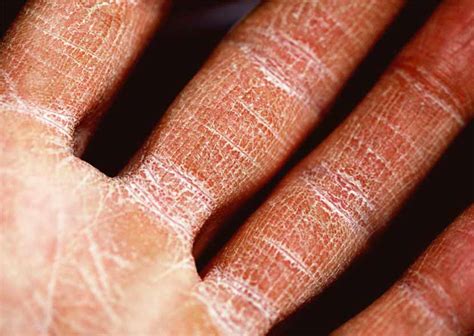 how to know if skin is dehydrated