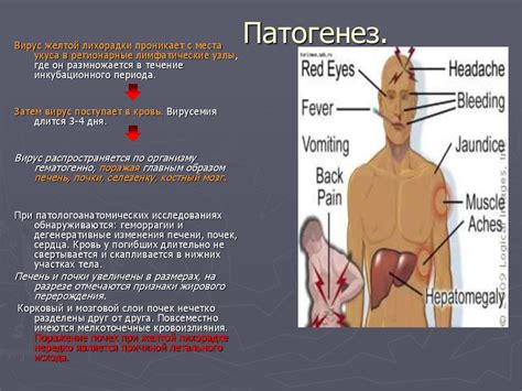 Желтая лихорадка - презентация онлайн