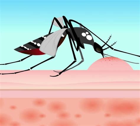 How To Identify & Treat A Bug Bite