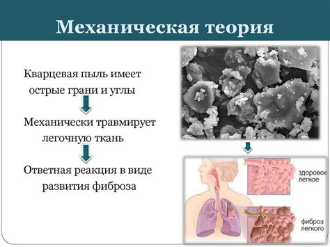 Силикоз - презентация онлайн