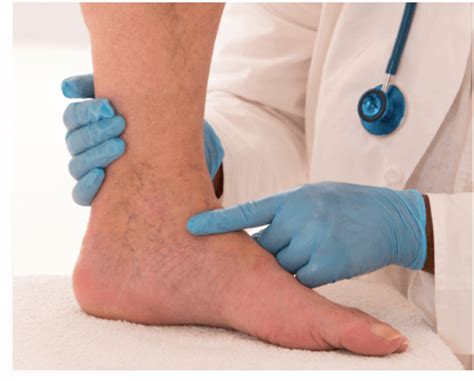 Lower Extremity Arterial Disease Doctor in Los Angeles