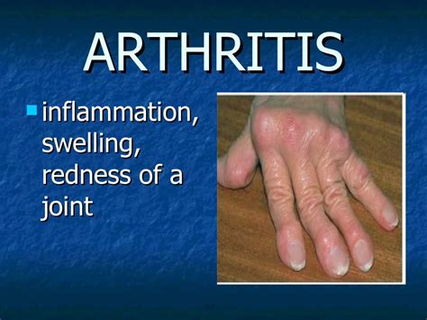 common diseases/disorders of the skeletal system