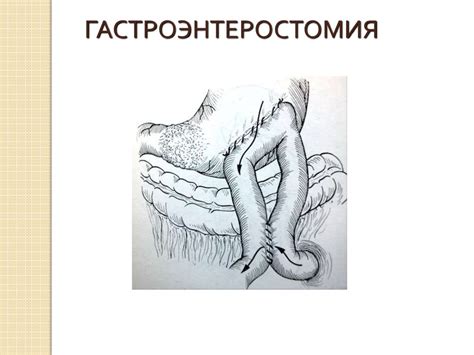 Заболевания желудка - презентация онлайн