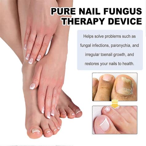 Nail Fungus Cleaning Laser Device, Nail Fungus Laser Treatment For