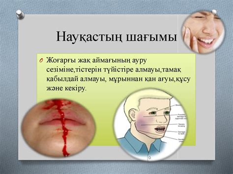 Сынықтар. Жоғарғы жақтың сынуы - презентация онлайн