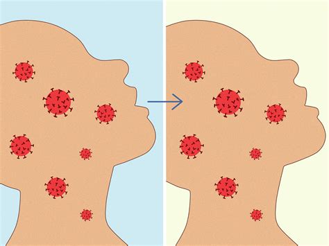 Sore Throat Gargle Sea Salt Water at Jo Diggs blog
