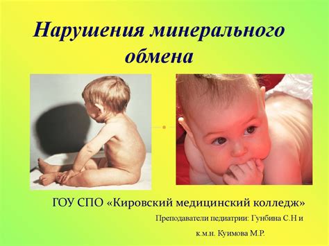 Нарушения минерального обмена. Рахит. Факторы, классификация ...