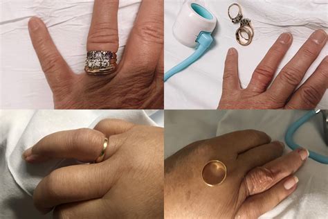 stuck ring removal solution ring rescue