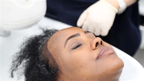 hair transplant aftercare   complete guide