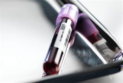 A blood test for autism? Not so fast, experts say | Spectrum | Autism ...