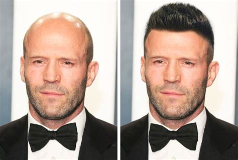 Calvo Com Cabelo Do Lado - Imaginamos como 15 celebridades calvos ficariam com cabelos (e o ...