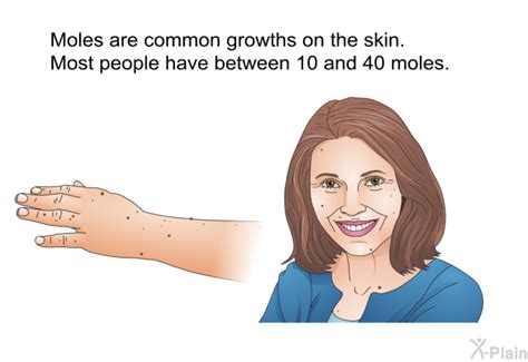 how to pronounce moles